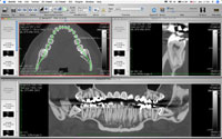 Curved-MPR Viewer