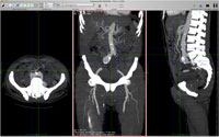 Ortho MPR Viewer