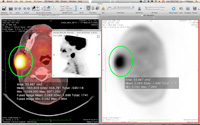 PET-CT Viewer