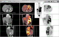 Ortho PET-CT Viewer